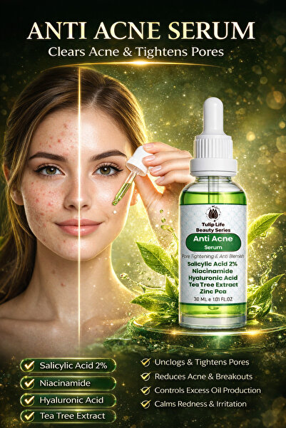 Tuliplife Anti Acne – Salicylic Acid 2% & Niacinamide – Pore Tightening & Oil...