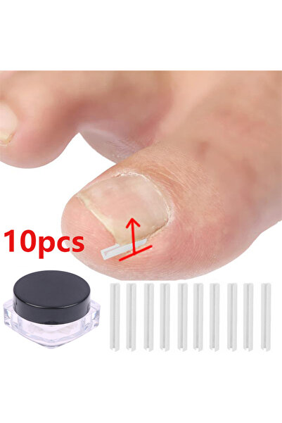 Choice ١٠ قطع من أسلاك تصحيح الأظافر الغائرة، لعلاج داء البارونيشيا، وتصحيح أ...