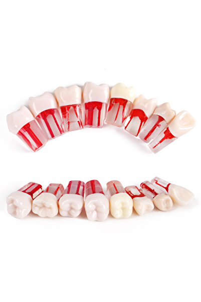 Choice8 5Pcs Number 26 5pcs Dental Teeth Root Canal Model Pulp Files Cavity E...