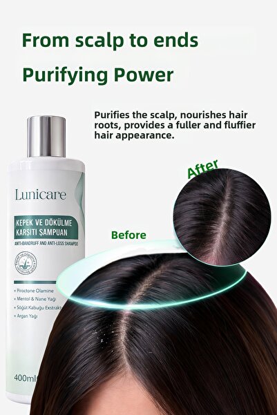 lunicare Anti-Dandruff and Anti-Hair Loss Shampoo Anti-Dandruff Salt-Free Shampoo 400 ml