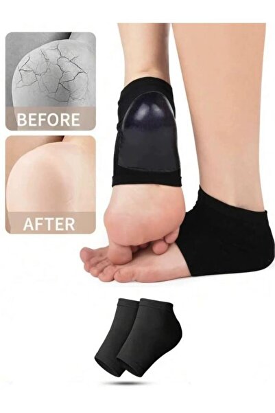 Nirnisa Siyah Renk Silikon Topuk Ayak Nemlendirici Çorap Çatlak Kuruluk Önley...