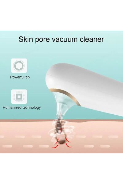 Yallabena 4-in-1 Skin Cleansing and Blackhead Suction Device