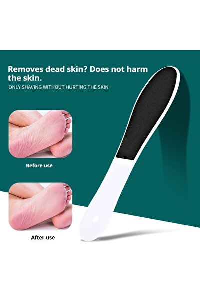 choice2 طقم باديكير خاص بالعطلات - قطعة واحدة - مزيل مسامير القدم مناسب للسفر...