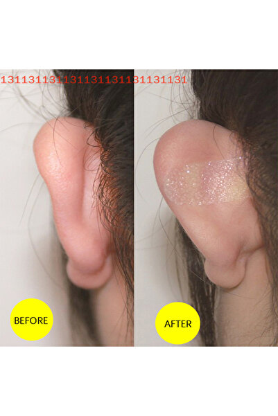 Choice 6 قطع/ورقة من ملصقات تصحيح الأذن التجميلية على شكل أذن قزم، دعامات للأ...