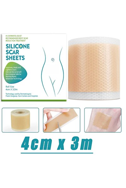 Choice 4cm x 3m 4CM x 3M Silicone Scar Sheets Self-Adhesive Stretch Mark Tape...