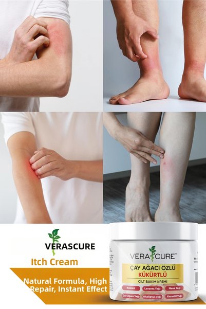 Vera Cure Tea Tree Extract Sulfur Cream for Fungus, Eczema, Psoriasis, Seborrhea