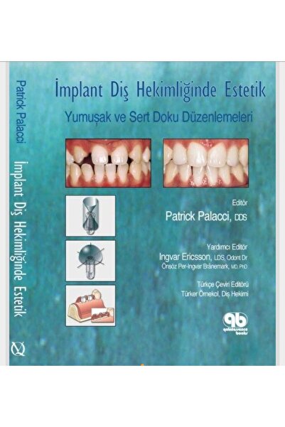 Genel Markalar Implant Diş Hekimliğinde Estetik