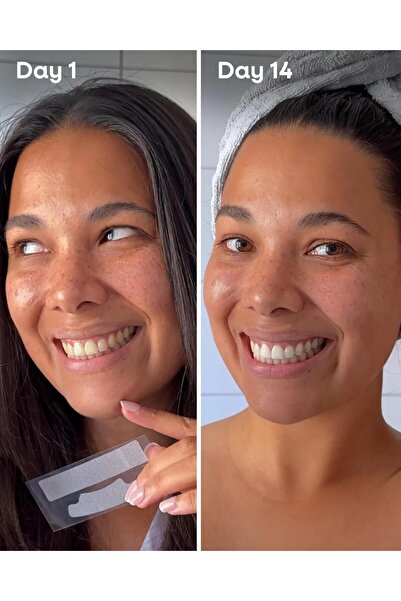 The Humble Co. Teeth Whitening Strips - Fresh Mint (28 Strips) Diş Beyazlatma Bandı Nane