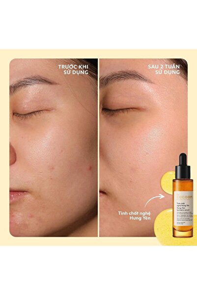 The Cocoon Original Vietnam سيروم N7 لحب الشباب بالقرع الشتوي