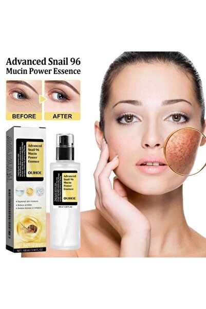 gen خلاصة بروتين الحلزون | ترطيب عميق، إصلاح البشرة وتفتيحها (100 مل)