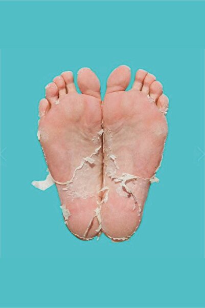 Skin Republic Foot Peel Foot Mask
