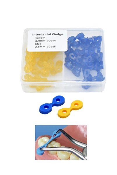 Choice 30 أصفر، 30 أزرق، 40 قطعة من مصفوفة إسفين الأسنان، فواصل أسنان، أسافين...