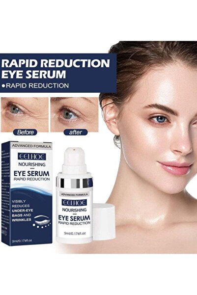 Arabest Rapid Reduction Eye Serum, Anti-Aging Treatment for Bags and Dark Cir...