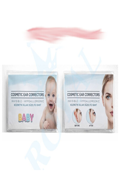Baby Bebekler Için Ameliyatsız Kepçe Kulak Düzeltici Bant - Bebeklere Özel Ha...