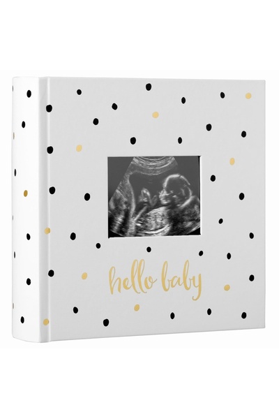 Hype Store Pearhead Hello Baby Fotoğraf Albümü, Yeni ve Bekleyen Ebeveynler i...