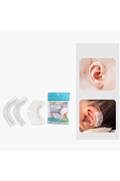 Choice3 D Protruding Ear Support Infant Corrector Tools Silicone Auricle Corr...