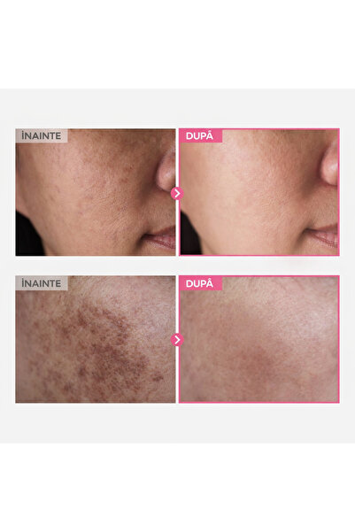 CARVENCHY Cremă ultra-iluminatoare cu acid tranexamic, niacinamidă și glutation – Reduce petele,