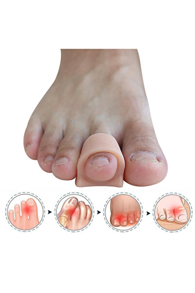 Choice4 4Pcs-Beige Pexmen 2/4Pcs Hammertoe Corrector Toe Splints Realign Bent...