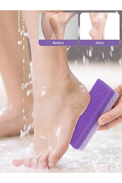 choice2 ٤ قطع - بنفسجي ١/٤/٦ قطع مبرد تقشير حجر الخفاف للقدم، مزيل الجلد المي...