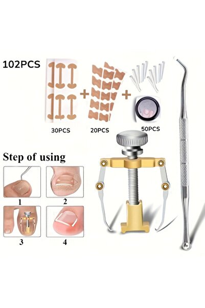 Choice Armor Set(102pcs) Professional Ingrown Toenail Correction Tool(102/104...
