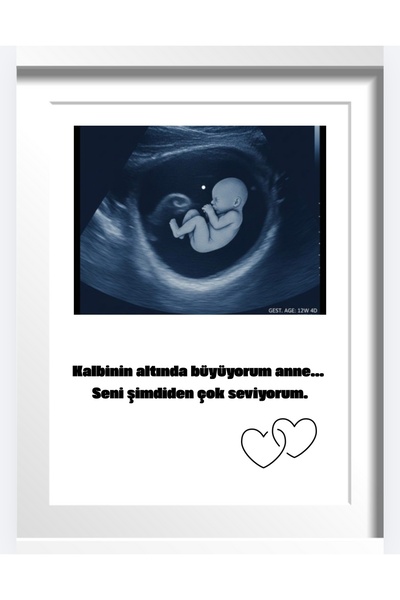 AY AN STUDYO Ultrason Fotoğrafı Kişiye Özel Çerceve Tablo Hamilelik Fotoğraf ...