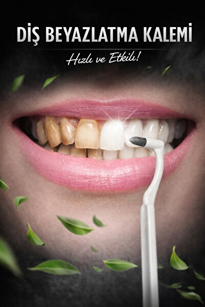 NOIRE PREMIUM BEYAZLATICI DİŞ SİLGİSİ - LEKE ,TARTAR KARŞITI (ÇAY,KAHVE ,SİGA...