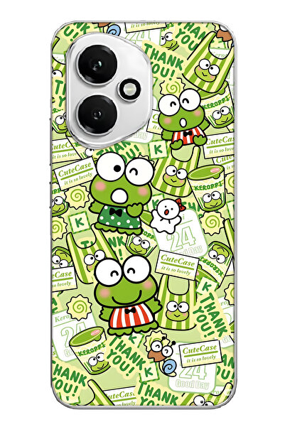 FLAMENKO غطاء هاتف شفاف بنمط الضفدع اللطيف متوافق مع هونور 400