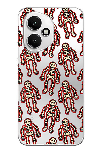 FLAMENKO غطاء هاتف شفاف بنمط هيكل عظمي متوافق مع هونر 400