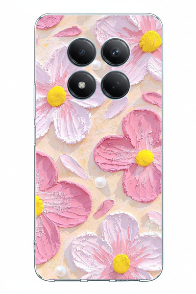 TechTree Redmi Note 15 PRO 5G Uyumlu Pembe Beyaz Çiçekler Sulu Boya Baskılı S...