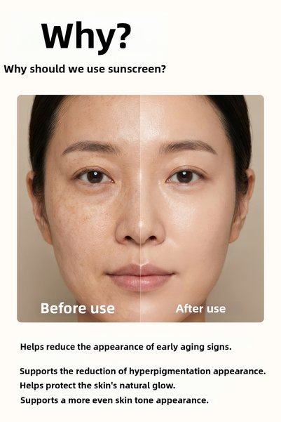 FOODAHOLIC Non-Sticky Anti-Blemish Sunscreen Containing Adenosine Spf50+ Pa+++ Uva/Uvb 70 ml Sunscreen