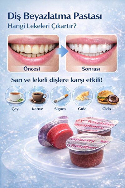 AVANT DENTAL SUPPLY Diş Beyazlatıcı Pasta 3 Adet