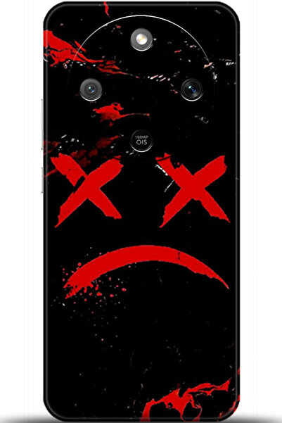 adveksiyon Honor Magic 8 Lite 5g Case Hd Printed Case - I Am Defenseless 5139