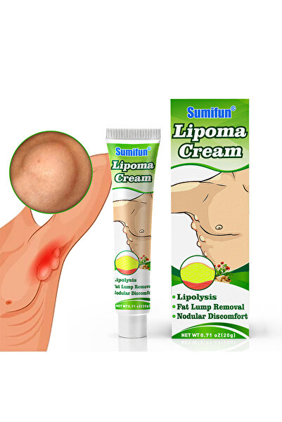 SUMIFUN كريم إزالة الأورام الشحمية، كريم متعدد الاستخدامات محمول لعلاج السيلو...