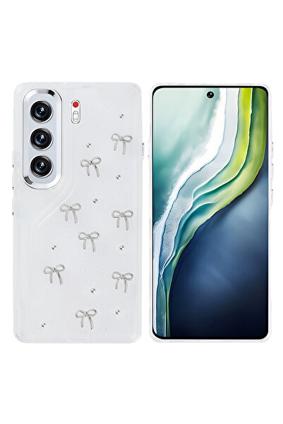 toyigoo Tecno Camon 40 Pro Case Airbag Design Glittery Transparent Tygo Pole ...