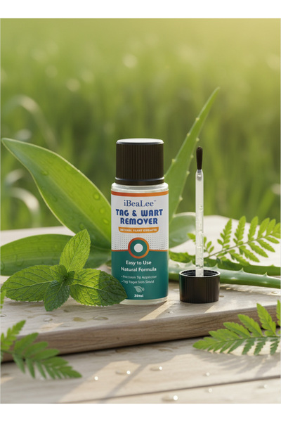 Generic Shuowoxin Wart Removal Liquid – Effective Solution for Common & Flat ...