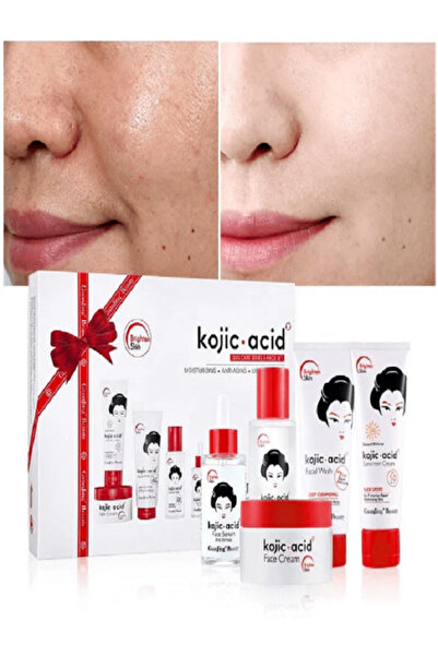 Kojie San Kojic Acid 7 Günde Cilt Yüz Kusurlarını Onarıcı Giderici Beyazlatma...