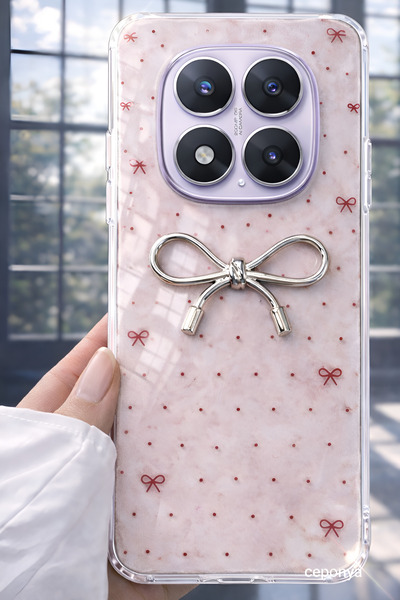 Ceponya Redmi Note 14 Pro Plus Case with Camera Protrusion, Shiny Figure, Shi...