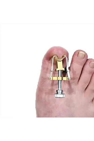 Genel Markalar Aveo 1 Adet Batık Tırnak Düzeltme Aleti