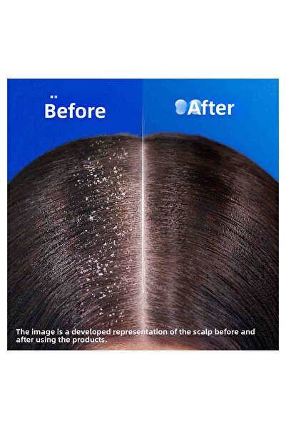 Head & Shoulders Șampon anti-mătreață Lemon Freshness pentru păr gras 330 ml x 3 bucăți
