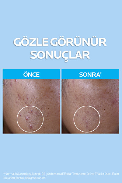 La Roche Posay Yağlı ve Sivilceye Eğilimli Ciltler Cilt Bakım Seti: Effaclar Tonik & Temizleme Jeli & Bakım Kremi