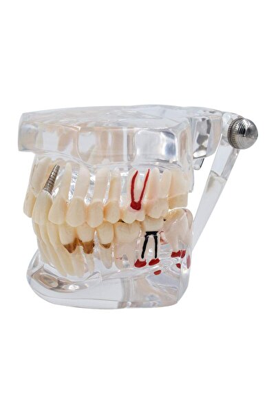 Zamo Dental Educational Model, Zamo, Demonstrates Pathologies, 31 Teeth Trans...
