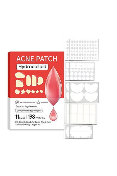 Choice لصقة أنف كبيرة الحجم لعلاج حب الشباب، لصقة للتحكم في الزيوت، مضادة لحب...