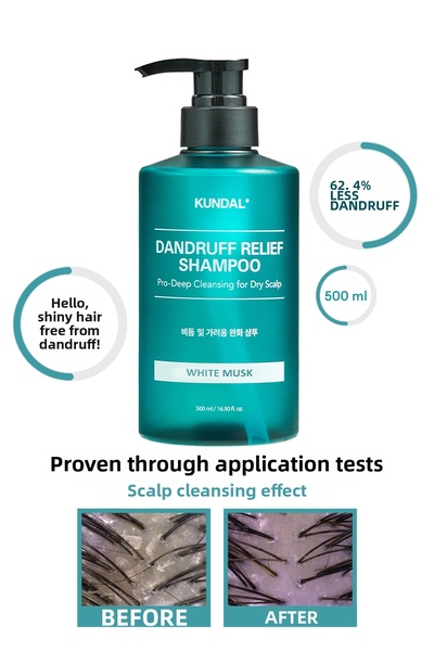Kundal شامبو مضاد للقشرة وعناية منقية، شامبو لتخفيف القشرة (المسك الأبيض)