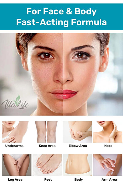 İlla Life Yüz & Cilt Beyazlatıcı Kararma Karşıtı Cilt Beyazlatma Kremi Whitening Hızlı Etkili 50ml