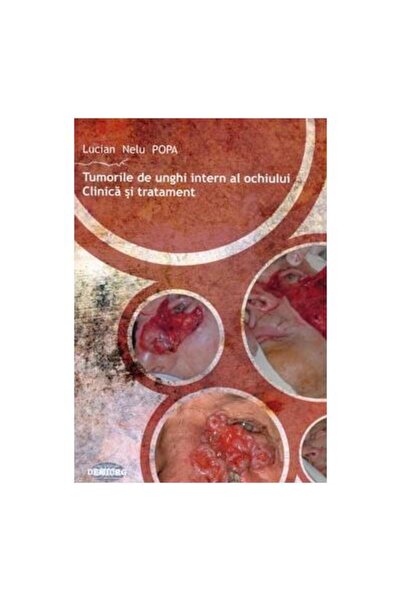 Editura Demiurg Tumorile de unghi intern al ochiului. Clinica si t
