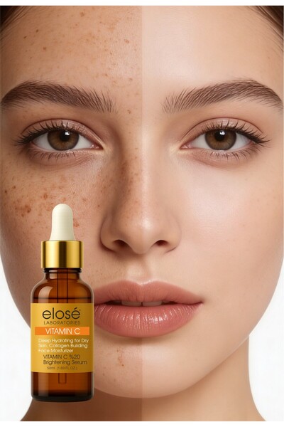 Elose Vitamin C Serum 50 ml – Skin Brightening, Anti-Blemish and Skin Tone Equalizing Serum