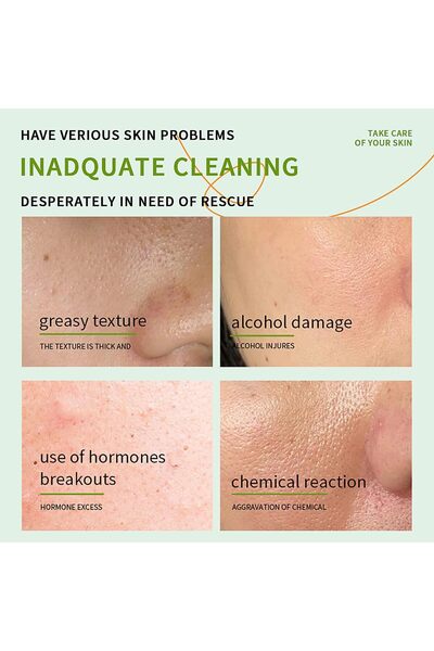 sador Aloe Vera Gel After Sun Hydrating & Nourishing Skin Care