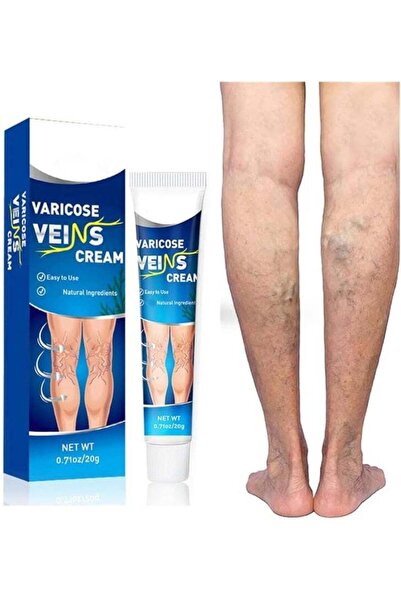 SUMIFUN Varicose Veins Cream by Vein Smoothing, Spider Veins Repair Cream for...