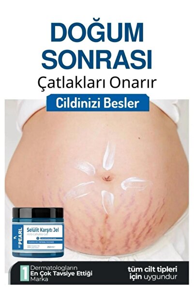 My pearl Ilnceltıcı ,1sıkılaştırıcı, Selülit Ve Çatlak Giderici Leke karşıtı ...