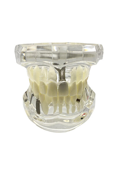 UBX Model demonstrativ dentar, dinți mobili, implanturi, restaurări, patologi...